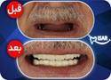 بیتوته