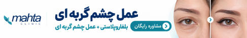 بلفاروپلاستی کلینیک ماهتا